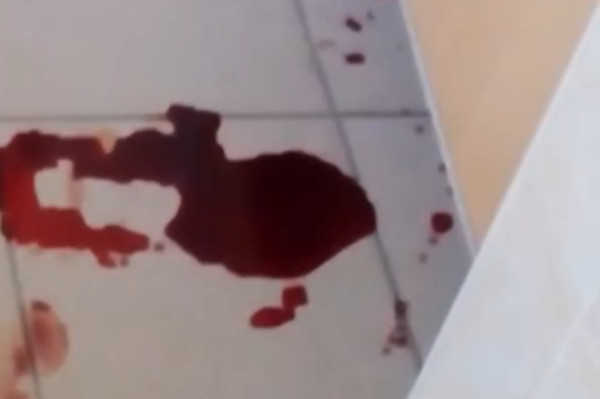 В рязанской БСМП очевидцы засняли лужи крови на полу. Видео В рязанской БСМП очевидцы засняли лужи крови на полу. Видео