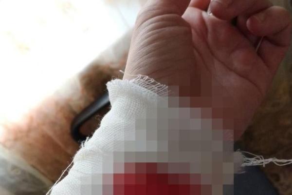 Жители Скопина заявили о случаях нападения бродячей собаки