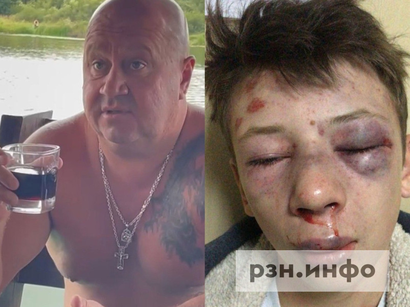В Пронске бизнесмен и педагог избили подростка за замечание не мочиться при людях