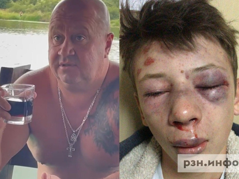 Избиение подростка в Пронске